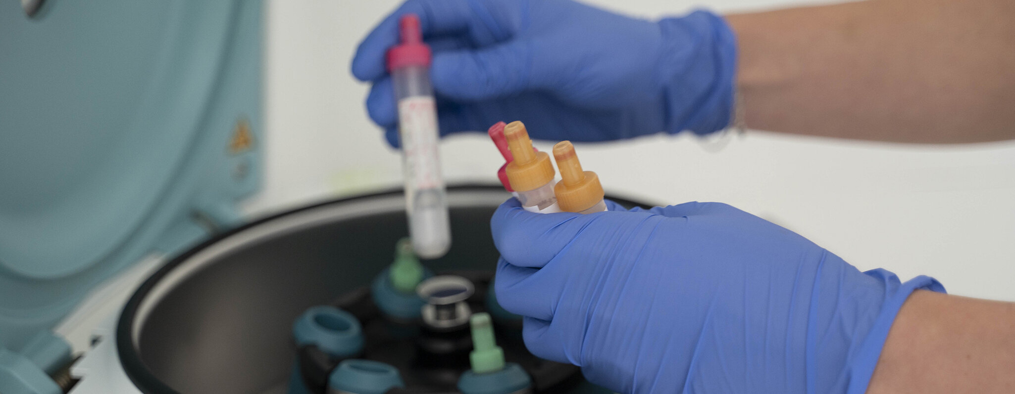 Blutproben werden für die Zentrifuge vorbereitet