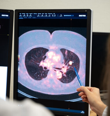 FDG PET/ CT