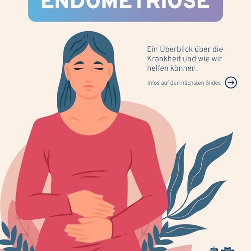 Endometriose ist eine der h&auml;ufigsten, aber oft sp&auml;t erkannten gyn&auml;kologischen Erkrankungen.

Sch&auml;tzungen zufolge ist...